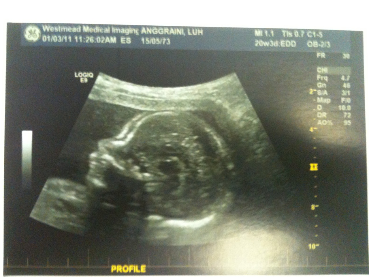 Ultrasound Pictures A Son In My Family